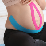 Czym jest kinesiology taping w ciąży?